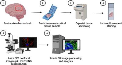 Advancements in high-resolution 3D microscopy analysis of endosomal morphology in postmortem Alzheimer’s disease brains